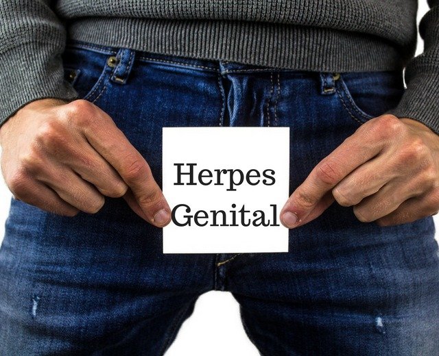 How To Cure Genital Herpes