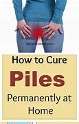 How To Cure Hemorrhoids