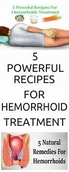 How To Treat Hemorrhoids Or Piles